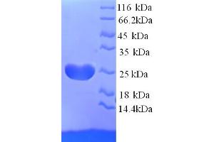 SDS-PAGE (SDS) image for Adiponectin (ADIPOQ) (AA 19-244) protein (His tag) (ABIN7691204)