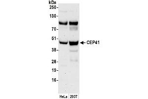 Western Blotting (WB) image for anti-Centrosomal Protein 41kDa (CEP41) (AA 150-200) antibody (ABIN7450106)
