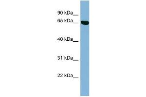 WB Suggested Anti-RIC8B Antibody Titration: 0. (RIC8B 抗体  (Middle Region))