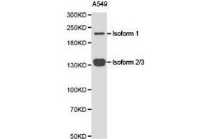 Western Blotting (WB) image for anti-Tet Methylcytosine Dioxygenase 2 (TET2) antibody (ABIN1875061) (TET2 抗体)