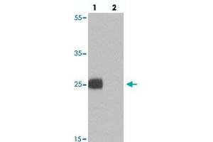 Western blot analysis of EMX1 in rat liver tissue with EMX1 polyclonal antibody  at 1 ug/mL in (lane 1) the absence and (lane 2) the presence of blocking peptide. (EMX1 抗体  (N-Term))