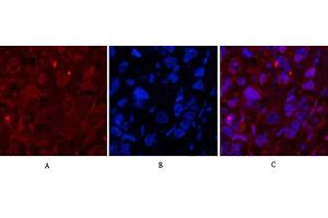 Immunofluorescence analysis of human breast cancer tissue. (Caspase 1 抗体  (Cleaved-Asp210))