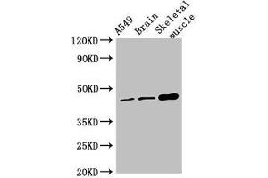 Western Blot Positive WB detected in: A549 whole cell lysate, Mouse brain tissue, Mouse skeletal muscle tissue All lanes: TMEM43 antibody at 4 μg/mL Secondary Goat polyclonal to rabbit IgG at 1/50000 dilution Predicted band size: 45 kDa Observed band size: 45 kDa (TMEM43 抗体  (AA 178-312))