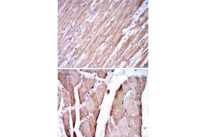 Immunohistochemical analysis of paraffin-embedded human cardiac muscle tissue (A) and striated muscle tissue (B) using TNNI2 monoclonal antobody, clone 2F12A8  with DAB staining. (TNNI2 抗体)