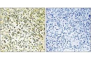 Immunohistochemistry analysis of paraffin-embedded human tonsil tissue, using NPM (Ab-234) Antibody. (NPM1 抗体  (AA 201-250))