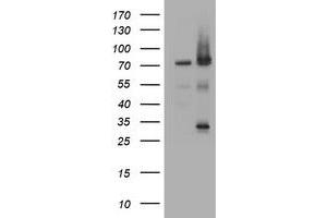Image no. 1 for anti-Receptor (TNFRSF)-Interacting serine-threonine Kinase 1 (RIPK1) (AA 133-422) antibody (ABIN1490912) (RIPK1 抗体  (AA 133-422))