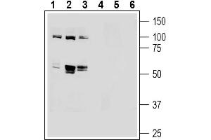 Western blot analysis of human Jurkat T-cell leukemia cell line lysates (lanes 1 and 4), human MDA- breast adenocarcinoma cell line lysates (lanes 2 and 5) and human  breast adenocarcinoma cell line lysates (lanes 3 and 6):1-3.