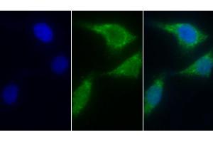 Detection of AIF in Human Hela cell using Polyclonal Antibody to Apoptosis Inducing Factor (AIF) (AIF 抗体  (AA 103-322))