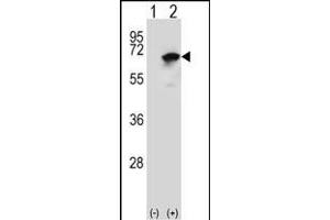 Western blot analysis of NARS (arrow) using rabbit polyclonal NARS Antibody (N-term) (ABIN655041 and ABIN2844672). (NARS 抗体  (N-Term))