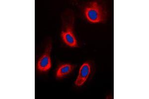 Immunofluorescent analysis of Caspase 3 staining in HeLa cells. (Caspase 3 抗体  (Center))