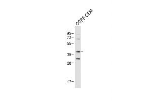 Anti-Mouse Nkx2-5 Antibody (Center) at 1:1000 dilution + CCRF-CEM whole cell lysate Lysates/proteins at 20 μg per lane. (NK2 Homeobox 5 抗体  (AA 98-133))