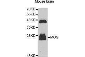 Western blot analysis of extracts of mouse brain, using MOG antibody. (MOG 抗体)