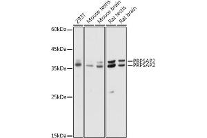 PRPSAP2 抗体  (AA 1-90)