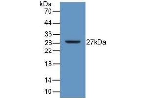 Detection of Recombinant ATP1b3, Human using Polyclonal Antibody to Sodium/potassium Transporting ATPase Subunit Beta-3 (ATP1b3) (ATP1B3 抗体  (AA 61-273))