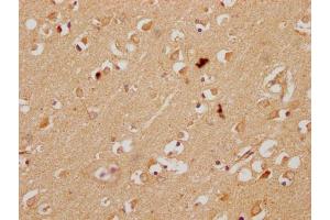 IHC image of ABIN7157259 diluted at 1:200 and staining in paraffin-embedded human brain tissue performed on a Leica BondTM system. (KBTBD7 抗体  (AA 475-684))