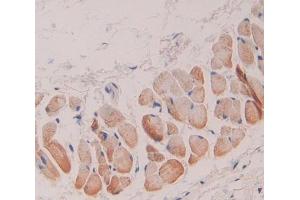 Used in DAB staining on fromalin fixed paraffin- embedded skin tissue (GSTT1 抗体  (AA 7-231))