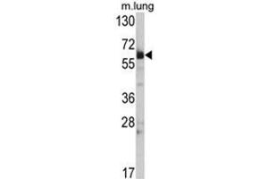 Western blot analysis of Hsp 60 Antibody (N-term) in mouse lung tissue lysates (35ug/lane). (HSPD1 抗体  (N-Term))