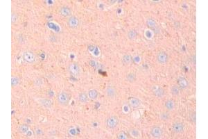 Used in DAB staining on fromalin fixed paraffin- embedded kidney tissue (ADAM10 抗体  (AA 218-445))
