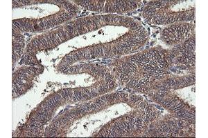 Image no. 5 for anti-Mitogen-Activated Protein Kinase Kinase 1 (MAP2K1) antibody (ABIN1499394) (MEK1 抗体)