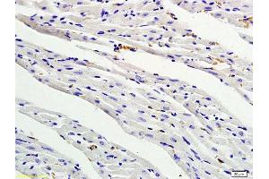 Formalin-fixed and paraffin embedded rat myocardium tissue labeled with Anti- PDGF-BB Polyclonal Antibody, Unconjugated (ABIN674874) followed by conjugation to the secondary antibody and DAB staining (PDGF-BB Homodimer (AA 151-241) 抗体)