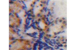 Used in DAB staining on fromalin fixed paraffin-embedded Kidney tissue