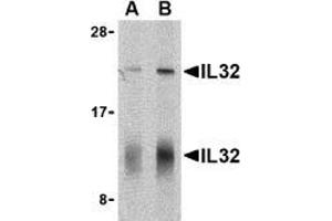 Western blot analysis of IL-32 in human spleen cell lysate with AP30424PU-N IL-32 antibody at (A) 5 and (B) 10 μg/ml shows two isoforms of IL-32. (IL32 抗体  (C-Term))