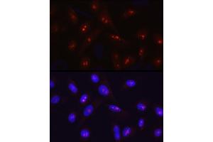 Immunofluorescence analysis of U2OS cells using SIRT7 Rabbit pAb (ABIN3021210, ABIN3021211, ABIN3021212 and ABIN6214068) at dilution of 1:50 (40x lens). (SIRT7 抗体  (AA 201-400))
