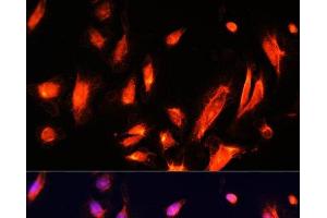 Immunofluorescence (IF) image for anti-ADP-Ribosylation Factor-Like 4A (ARL4A) antibody (ABIN7259554)