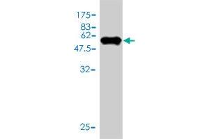 Western Blotting (WB) image for anti-Thiopurine S-Methyltransferase (TPMT) (AA 1-245) antibody (ABIN563239)