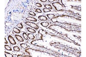HMGB1 was detected in paraffin-embedded sections of rat intestine tissues using rabbit anti- HMGB1 Antigen Affinity purified polyclonal antibody (Catalog # ) at 1 µg/mL. (HMGB1 抗体  (C-Term))