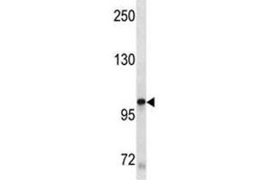 Western Blotting (WB) image for anti-Mast/stem Cell Growth Factor Receptor (KIT) antibody (ABIN3028783)