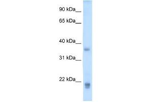 WB Suggested Anti-GH2 Antibody Titration:  5. (Growth Hormone 2 抗体  (Middle Region))