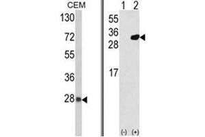 (LEFT) Western blot analysis of PRDX6 Antibody (C-term) in CEM cell line lysates (35ug/lane). (Peroxiredoxin 6 抗体  (C-Term))
