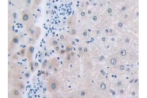 Immunohistochemistry (IHC) image for anti-Solute Carrier Family 12 (Sodium/Chloride Transporters), Member 3 (SLC12A3) (AA 3-146) antibody (ABIN7435784)