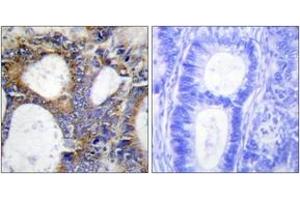 Immunohistochemistry (IHC) image for anti-Collagen, Type I, alpha 2 (COL1A2) (AA 471-520) antibody (ABIN1534337)