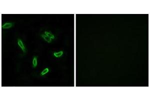 Immunofluorescence (IF) image for anti-Solute Carrier Family 27 (Fatty Acid Transporter), Member 5 (SLC27A5) (Internal Region) antibody (ABIN1850922) (SLC27A5 抗体  (Internal Region))