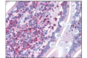 Human Small Intestine: Formalin-Fixed, Paraffin-Embedded (FFPE) (FNBP1 抗体  (Internal Region))