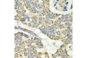 Immunohistochemistry (Paraffin-embedded Sections) (IHC (p)) image for anti-Tu Translation Elongation Factor, Mitochondrial (Tufm) (AA 186-455) antibody (ABIN6149701)
