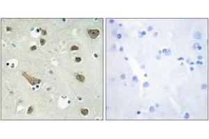 Immunohistochemistry analysis of paraffin-embedded human brain tissue, using 14-3-3 gamma Antibody. (14-3-3 gamma 抗体  (AA 51-100))