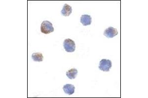 Immunocytochemistry of Parc in Daudi cells with this product at 1 μg/ml. (CUL9 抗体  (C-Term))