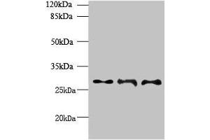 Western blot All lanes: BARX1 antibody at 6 μg/mL Lane 1: Hela whole cell lysate Lane 2: Jurkat whole cell lysate Lane 3: CEM whole cell lysate Secondary Goat polyclonal to rabbit IgG at 1/10000 dilution Predicted band size: 28, 12 kDa Observed band size: 28 kDa (BARX1 抗体  (AA 1-100))