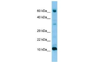 WB Suggested Anti-FABP9 Antibody Titration: 1. (FABP9 抗体  (Middle Region))