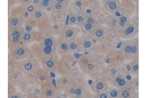 Detection of PDL1 in Mouse Liver Tissue using Polyclonal Antibody to Programmed Cell Death Protein 1 Ligand 1 (PDL1) (PD-L1 抗体  (AA 48-290))