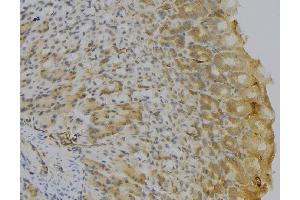 ABIN6277150 at 1/100 staining Human gastric tissue by IHC-P. (HLA-DQA1 抗体)