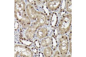 Immunohistochemistry (IHC) image for anti-Sequestosome 1 (SQSTM1) (AA 1-440) antibody (ABIN6148419)