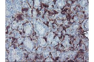 Image no. 1 for anti-alpha-2-HS-Glycoprotein (AHSG) antibody (ABIN1496502) (Fetuin A 抗体)