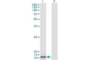 Western Blot analysis of S100A7 expression in transfected 293T cell line by S100A7 monoclonal antibody (M07A), clone 3E11. (S100A7 抗体  (AA 1-101))