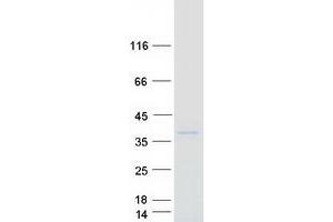 Western Blotting (WB) image for Carcinoembryonic Antigen-Related Cell Adhesion Molecule 3 (CEACAM3) protein (Myc-DYKDDDDK Tag) (ABIN2713761)