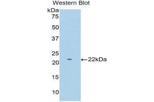 Western Blotting (WB) image for anti-Tumor Necrosis Factor Receptor Superfamily, Member 1B (TNFRSF1B) (AA 303-474) antibody (ABIN3206519) (TNFRSF1B 抗体  (AA 303-474))