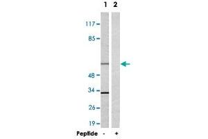 Western blot analysis of extracts from 293 cells, using TRAF3IP3 polyclonal antibody . (TRAF3IP3 抗体)